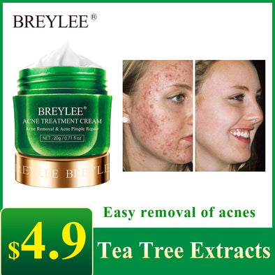 BREYLEE Acne Treatment Cream Anti Acne Face Cream Pimple Removal Spots Oil Control Shrink Pores Moisturizing Skin Care Serum 20g