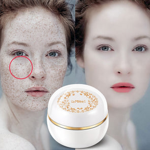 Lady skin magic cream Glow freckles whitening cream freckles tan plaques  Facial skin care Brighter Smooth spot remover 38g